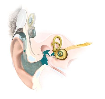 Kulak Anatomisi SONNET 2 EAS