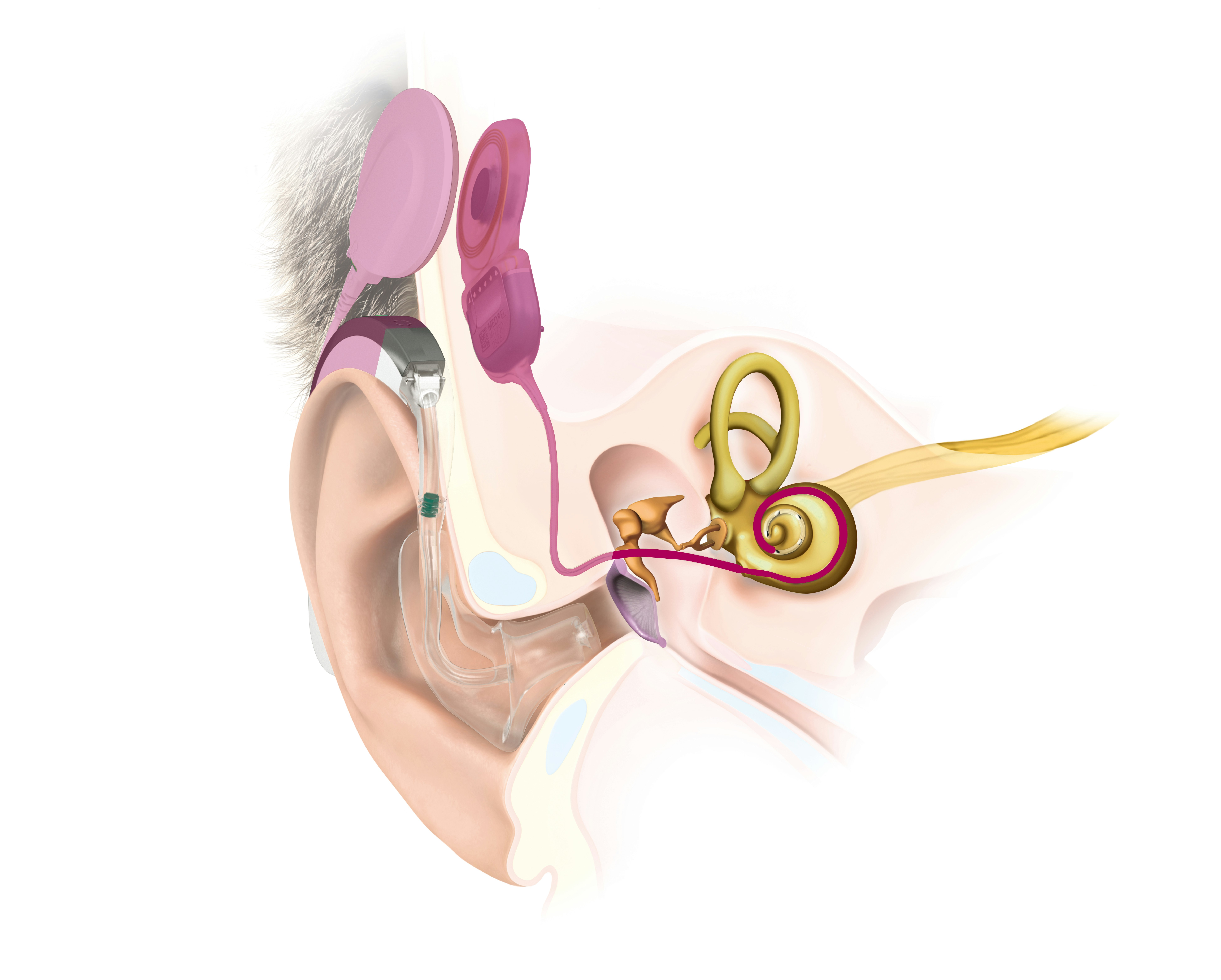 Anatomia urechii cu SYNCHRONY 2 EAS