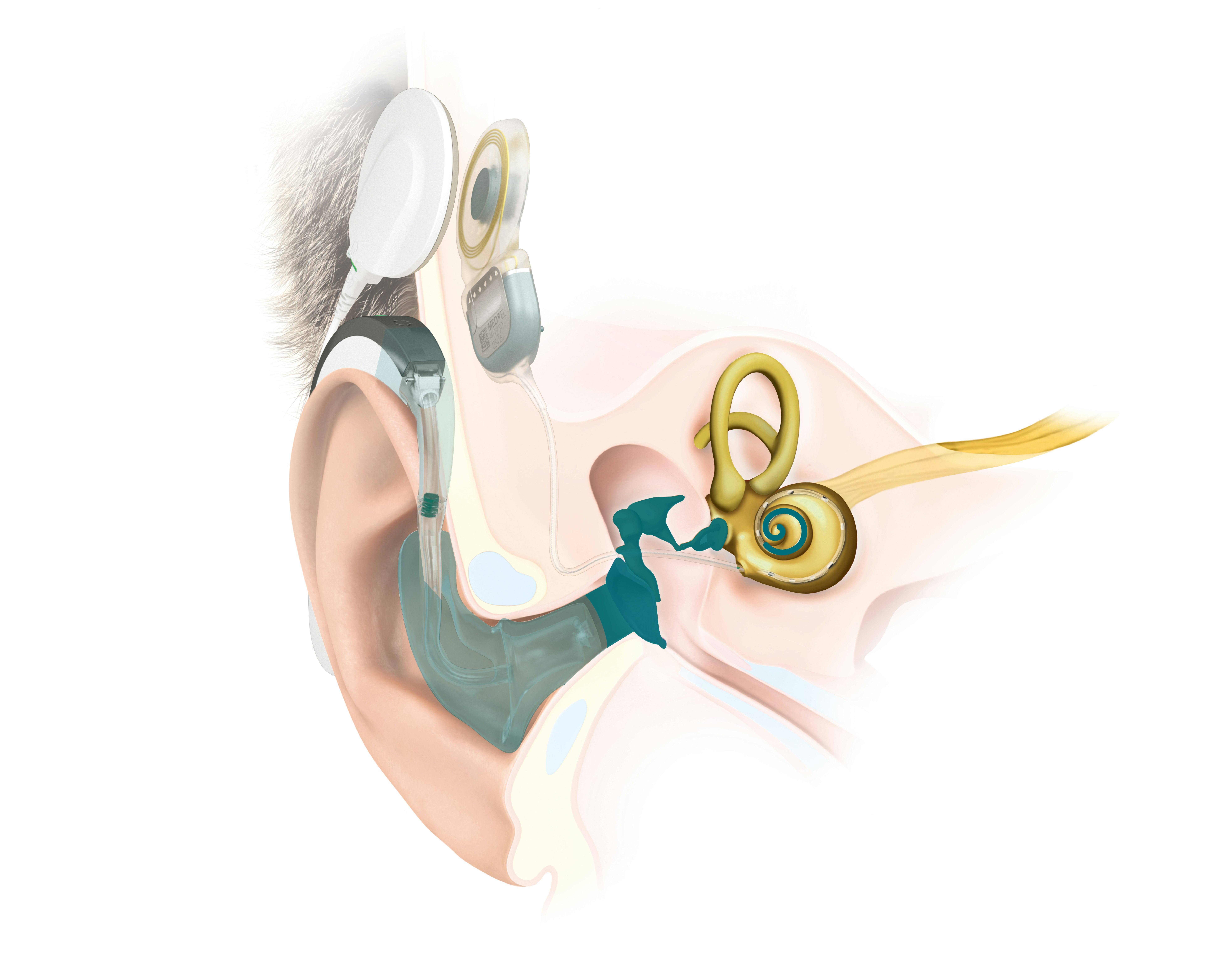 SONNET 2 EAS Anatomie des Ohres